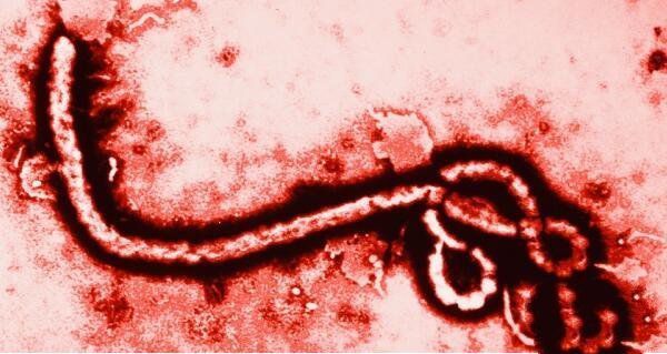 世界上最最危险的几个病毒，埃博拉病毒至今还没有治疗办法